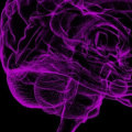 Is neurodiversity caused by trauma?